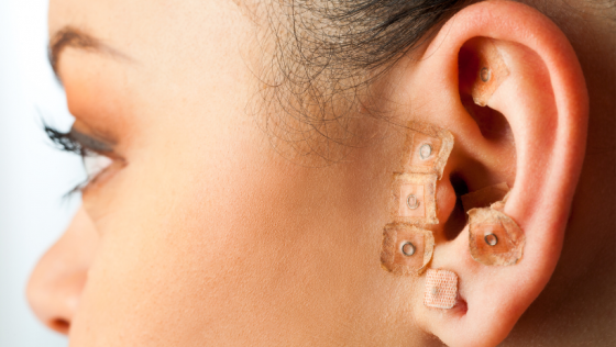 Curso de Auriculopuntura